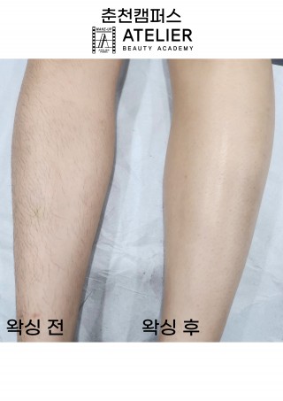 다리 왁싱
